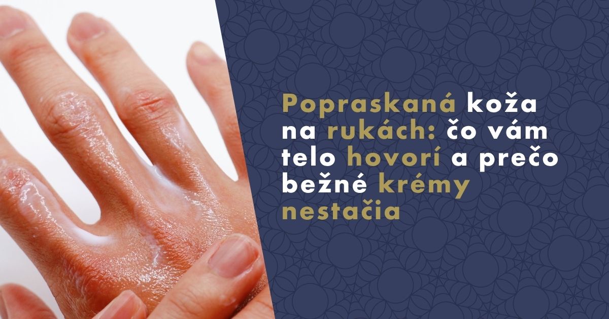 popraskana-koza-na-rukach (2)